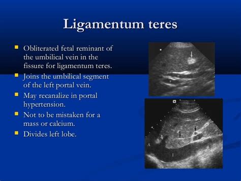 Liver ultrasound