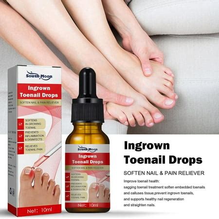 Ingrown Toenails - Ingrown Toenail Pain Relief and Softener Kit, 10ml ...