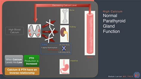 Hyperparathyroidism Diagnosis for Parathyroid Disease | Dr. Larian