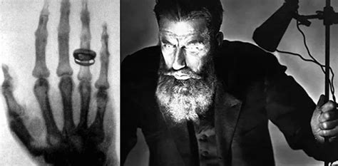 X-Rays: Roentgen's discovery that rocked the scientific world