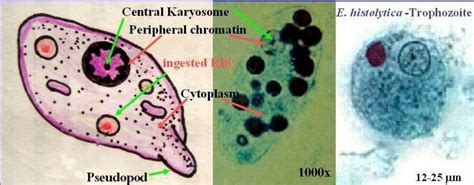 entamoeba histolytica trophozoite - Google Search | Entamoeba histolytica, Medical laboratory ...