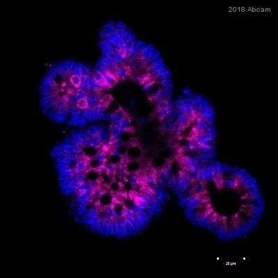 LAMP1抗体- Lysosome Marker (ab24170)| Abcam中国