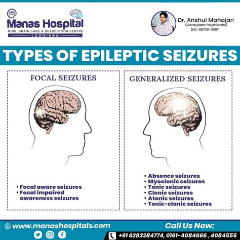 What all do you need to know about epileptic seizures and symptoms?