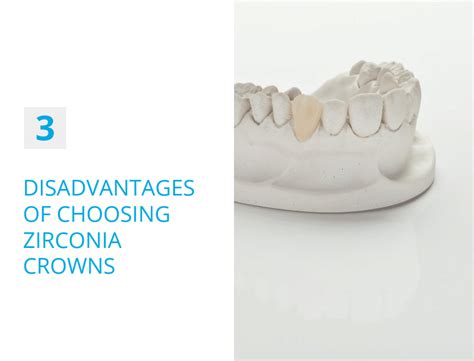 The Advantages And Disadvantages Of Zirconia Dental Crowns - Emerginnova