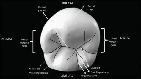 The Permanent Maxillary and Mandibular Premolar Teeth | Dental anatomy ...