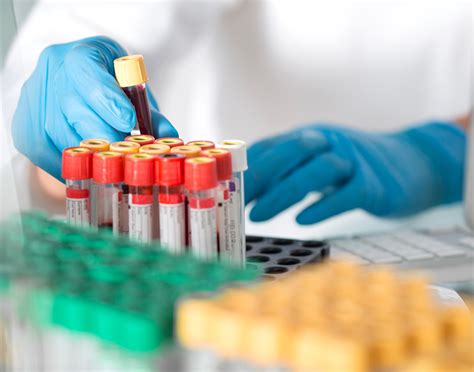 Albumin blood (serum) test