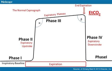 The morphology of the "normal" capnogram.| EtCO2 = end-tidal carbon ...