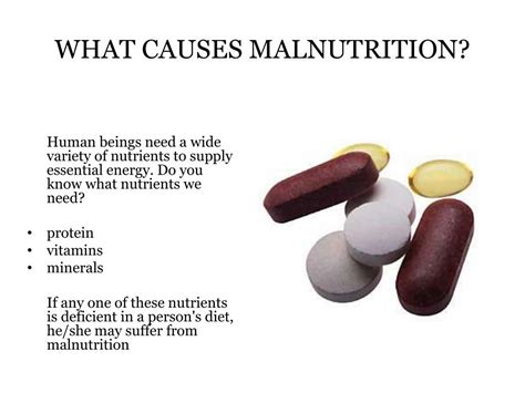 PPT - Causes of Malnutrition PowerPoint Presentation, free download ...