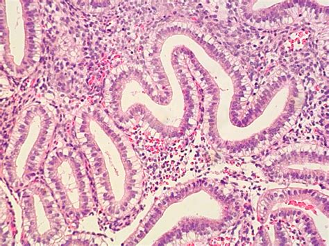 Endometrial Glands Histology