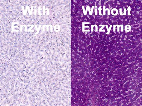 Periodic Acid Schiff (PAS) Glycogen Histology Slides