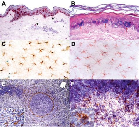 Dendritic Cells: Location, Function, and Clinical Implications | IntechOpen