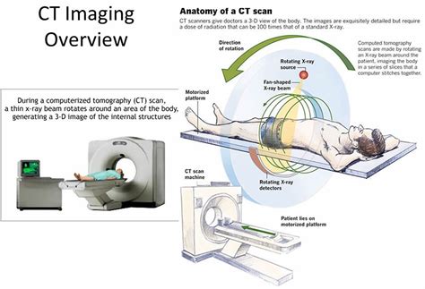 CT Scan - CAT Scan, Machine, Uses, Prep, Side Effects