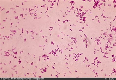 Salmonella Enterica Gram Stain