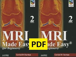 MRI Made Easy PDF E-book | BooksDoctor