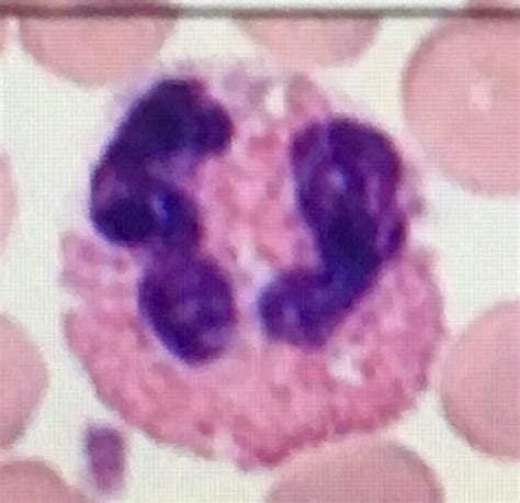 High Low Absolute Eosinophil Count Functions