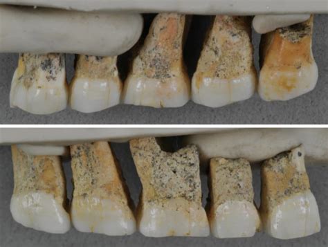 Callao Man: Meet The Early Human Hobbit Known As Homo Luzonensis