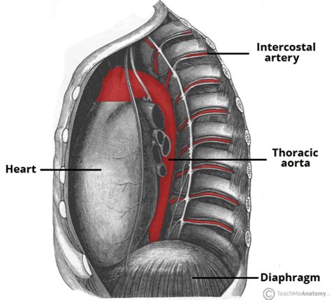 Thoracic Aortic Aneurysms - Clinical Features - Management - TeachMeSurgery