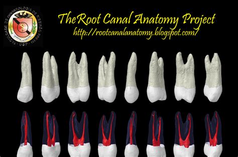 The Root Canal Anatomy Project: Maxillary First Premolar