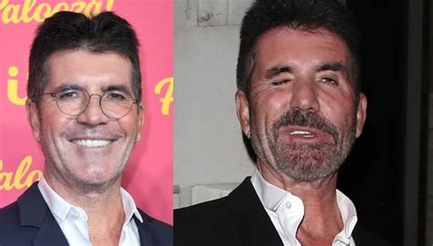 Simon Cowell snapped again with radically transforming face on date ...