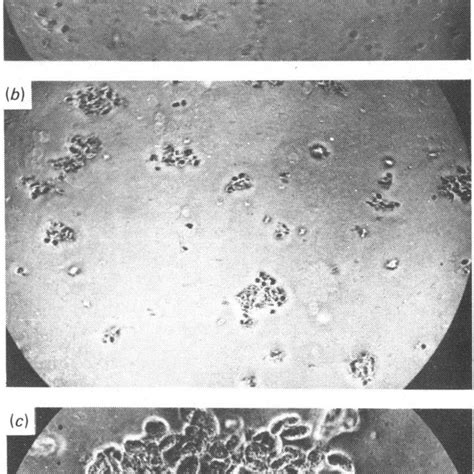 Agglutination o the amoebocytes by the haemagglutinin as observed under... | Download Scientific ...