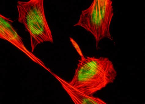 Fibroblasts with Alexa Fluor 568 and LysoTracker DND-26 | Nikon’s ...