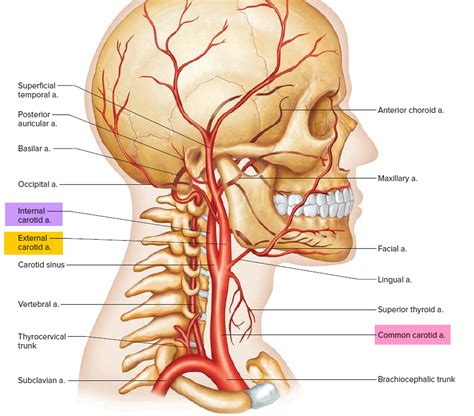 Carotid artery disease - Stenosis, Carotid Artery Dissection