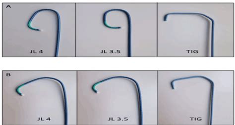 When right is left and left is right: using the JL3.5 guide catheter for left and right coronary PCI