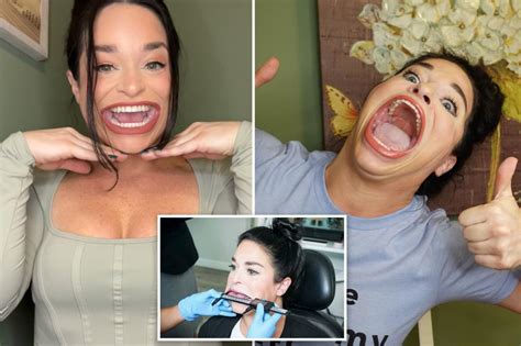 Samantha Ramsdell, woman with world’s largest mouth, ignores TikTok hate to make serious cash