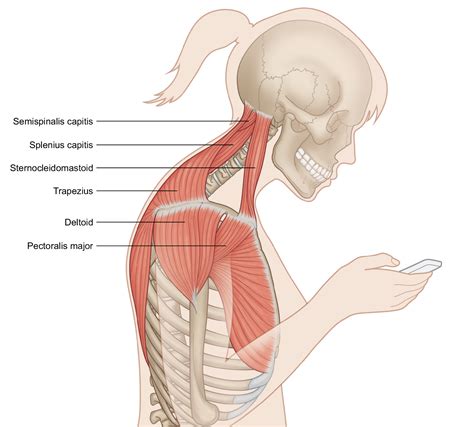 Forward Head Position and Chronic Pain — Stacy Dockins