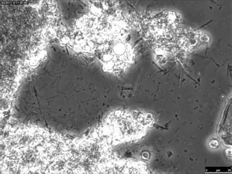 Dental Plaque Sample Under A Microscope