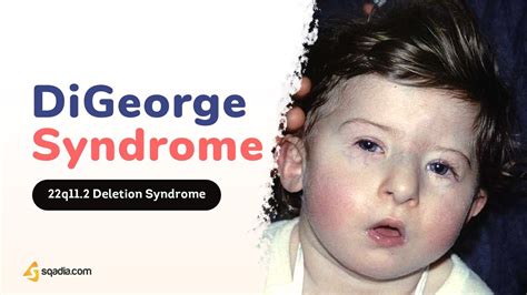 DiGeorge Syndrome Pathophysiology | 2-Minute Neurology Video | V ...