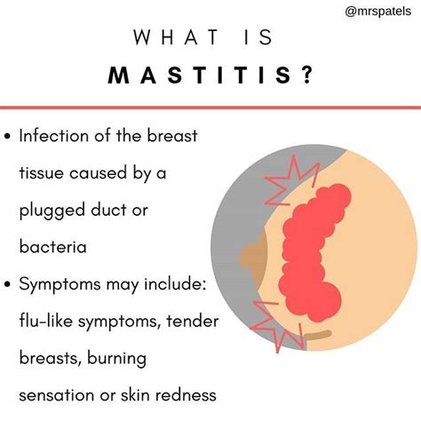 Mastitis