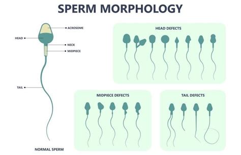 Sperm Morphology Criteria