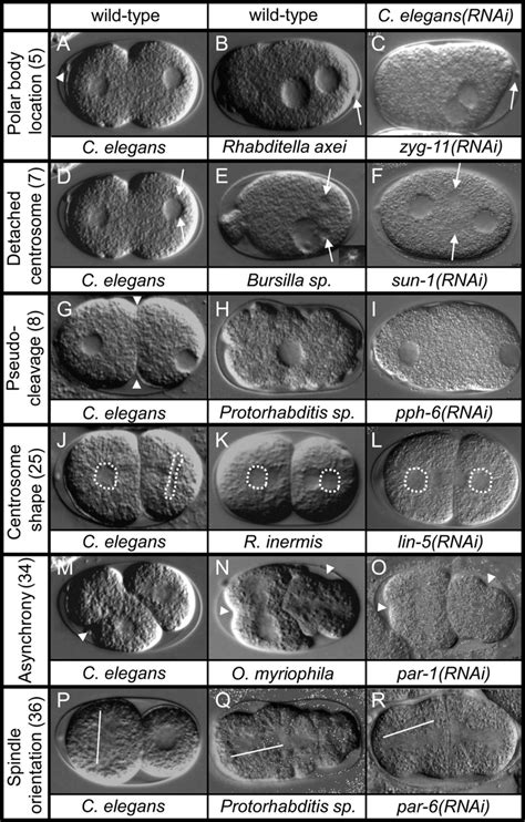 RNAi experiments in C. elegans mimic phenotypes in other species DIC... | Download Scientific ...