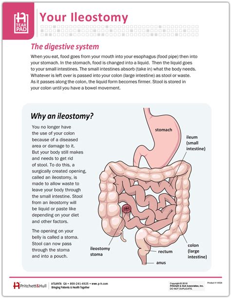 Your ileostomy Tearpad (50 sheets per pad) - Pritchett and Hull