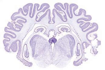 Animal Brains - Brain, sheep