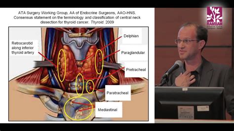 Thyroid Cancer Surgery