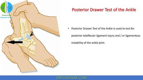 Posterior And Anterior Drawer Test