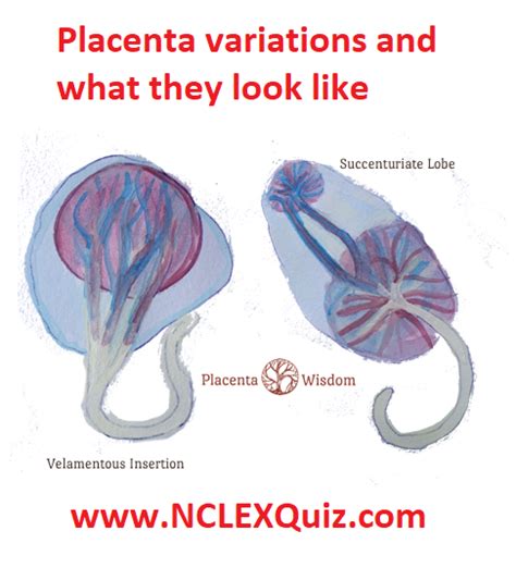 ArtStation Placenta Anatomy Resources, 51% OFF