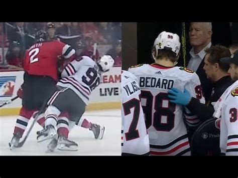 Connor Bedard Has Surgery, Timeline Revealed - NHL Trade Rumors ...