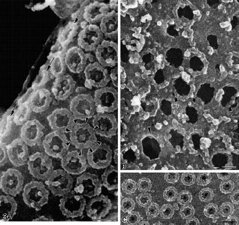 Figure 3 from The nuclear pore complex: three-dimensional surface structure revealed by field ...