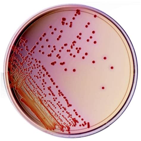 Thermo Scientific Yersinia Selective Agar:Microbiological Media and Media | Fisher Scientific