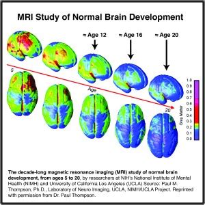 Brain Development and Substance Use - BreakingTheCycles.com