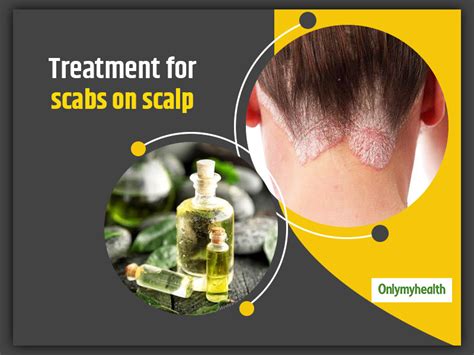 Experiencing Scabs On Scalp? Check Out These Symptoms, Causes And ...