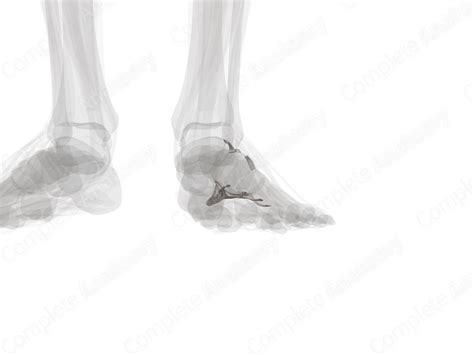 Calcaneocuboid Joint (Left) | Complete Anatomy