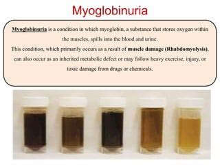 Hematuria | PPT