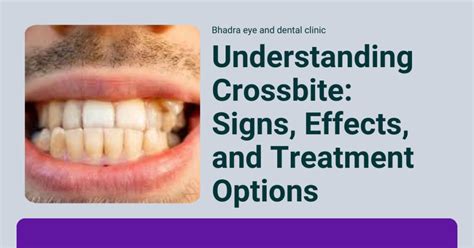 Understanding Crossbite: Signs, Effects, and Treatment Options - bhadra eye dental clinic