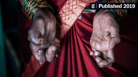 In India, a Renewed Fight Against Leprosy - The New York Times