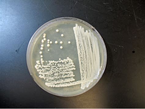 FUNGI – Red Mountain Microbiology