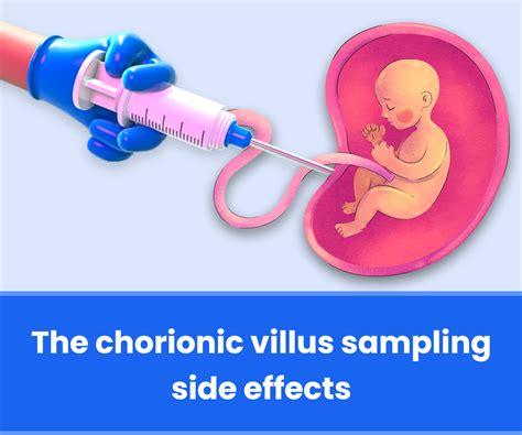 The chorionic villus sampling side effects